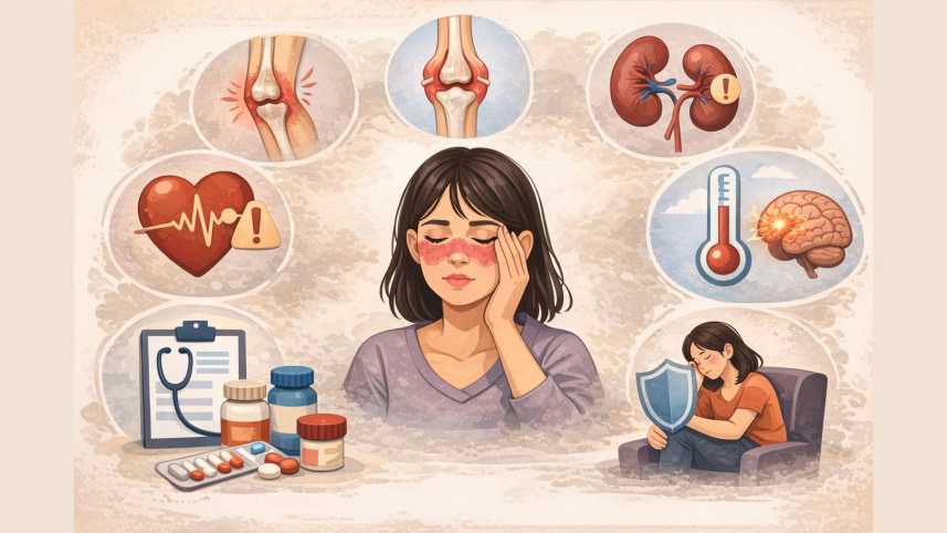 SLE Disease