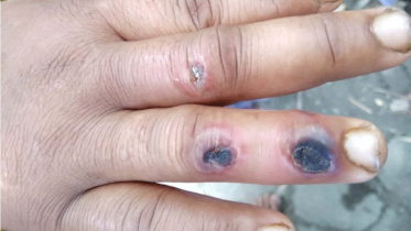 anthrax_1.jpg